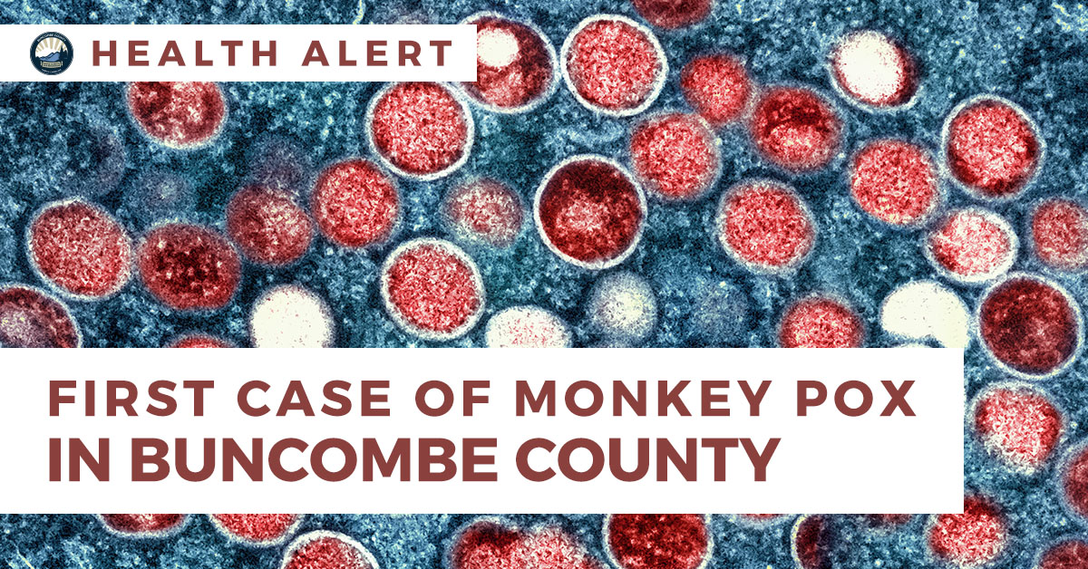 Health Alert: Buncombe County HHS Confirms First Case of Monkeypox